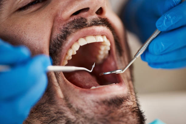 Best Teeth Whitening  in Coshocton, OH