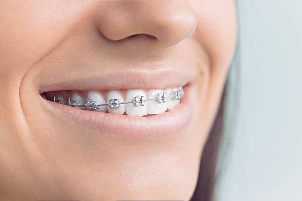 Best Full Mouth Reconstruction  in Coshocton, OH